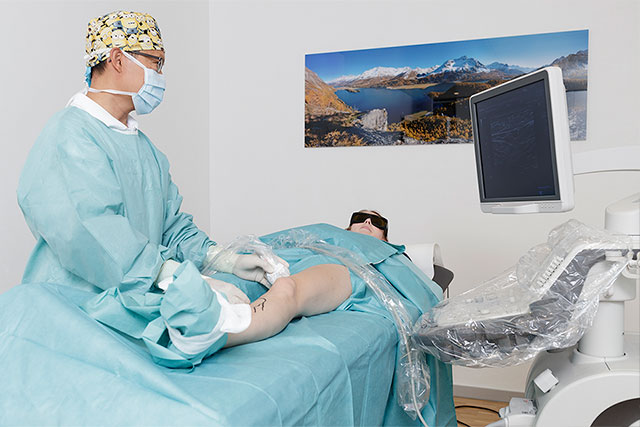 Radiofrequenztherapie: Minimal-invasive Krampfaderentfernung Foto der Radiofrequenztherapie mit Dr. Keo